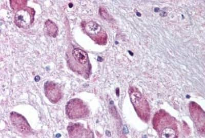 Immunohistochemistry-Paraffin: GABA-AR alpha 3 Antibody [NBP3-14327] - Immunohistochemistry of formalin-fixed, paraffin-embedded human brain, basal nucleus of Meynert after heat-induced antigen retrieval.